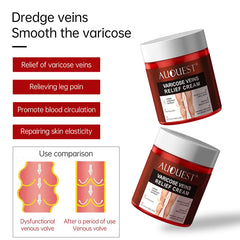 Varicose Veins Relief Cream